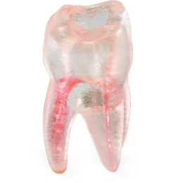 Endo 3DP™#14 Accessed Molar (UL6)