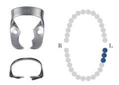 Wingless Molar LL Clamp 30 Black
