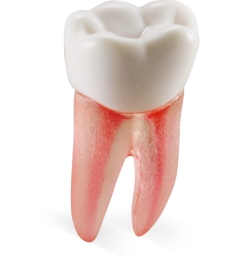 Real-T-Endo™ #19 Molar (LL6)